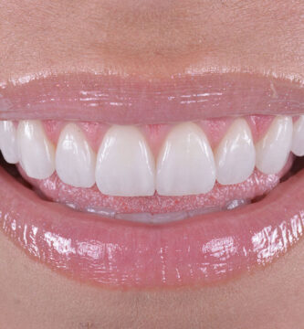 Endodoncia: Salvando Dientes y Aliviando el Dolor Dental