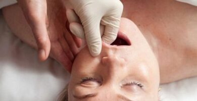 Expansor de Paladar: Un Tratamiento Clave para la Salud Dental 8 Expansor de Paladar: Un Tratamiento Clave para la Salud Dental